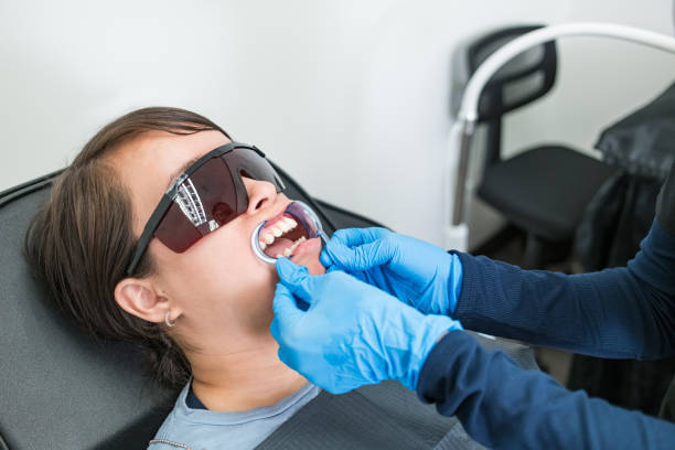 Best Teeth Whitening  in Fairview Ferndale, PA